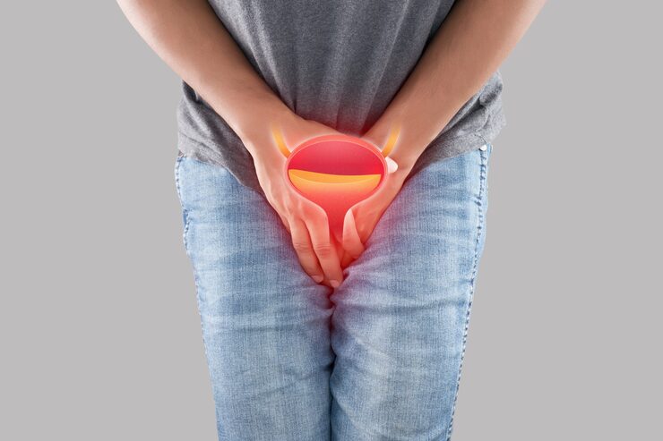 Bladder Cancer